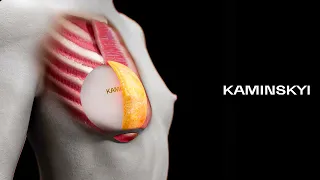 Round implants above the muscle / KAMINSKYI