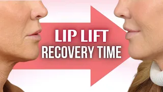 Lip Lift Recovery Time | Lesson Of The Day