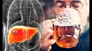 Anatomy and Physiology of Alcohol Effects Dangers / How Alcohol Effects ?