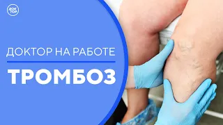 Доктор на работе. Тромбоз