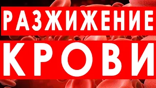 Разжижение Крови – Как Избежать Тромбоза | Полезные Советы для Жизни