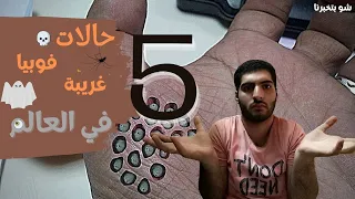 أغرب 5 حالات فوبيا موجودة حول العالم!