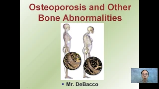 Osteoporosis and Other Bone Abnormalities