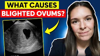 What causes blighted ovum (anembryonic pregnancy)?