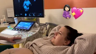 Dernière ÉCHOGRAPHIE...(T3) 🤰🏻​👶🏻: CÉSARIENNE ou VOIE BASSE ? 😰​