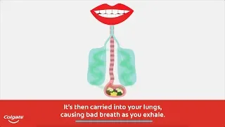 Explore the Causes of Bad Breath and Halitosis Remedies with Colgate®