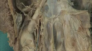 1.9 Step 9. Branches of the nasociliary nerve and ophthalmic artery