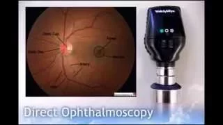 Direct Ophthalmoscopy