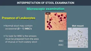 Interpretation of Stool Examination