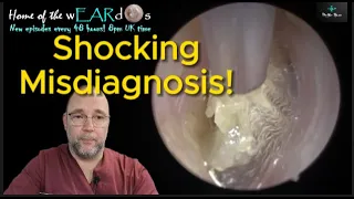 SHOCKING MISDIAGNOSIS! 251 #ear #earwax #earwaxremoval #earcleaning #fyp #asmr #asmrearwax #foryou