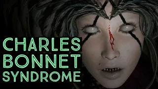 Charles Bonnet Syndrome