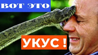 Чудеса в Библии. Как выжить при укусе змеи?