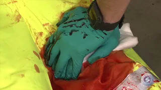 Lifesaving First Aid - Major Bleed