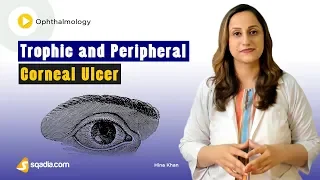 Trophic and Peripheral Corneal Ulcer | Medical Ophthalmology Lectures | V-Learning