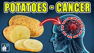 Never Eat Potato with This 🥔 Cause Cancer and Dementia! 3 Best & Worst Food Recipe 🍟! Dr.John