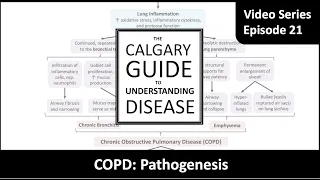 COPD Pathogenesis