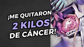 ¡Me quitaron 2 kilos de cáncer! Les cuento todos los detalles.