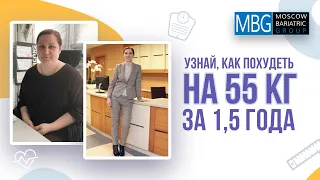 Минус 55 кг за 1,5 года после рукавной гастропластики | Отзыв пациента