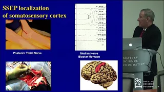 Functional Mapping & Awake Craniotomies - Daniel L. Silbergeld, MD, FACS, FAANS