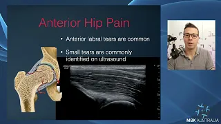 Hip Assessment for POCUS clinicians