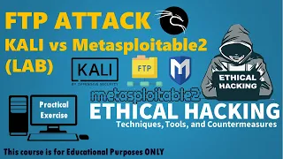 Ethical Hacking Lab: Exploiting FTP on Metasploitable2 with Kali Linux