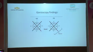 AIOC2022  IC171 topic Dr  NAIR ADITI ASHOK  Anterior Chamber assessment