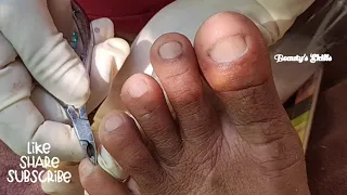 Easy pedicure without ingrown(Part2) | Beauty's  Skills