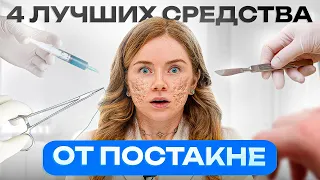 Как избавиться от постакне? Пошаговый рецепт от пятен и рубцов