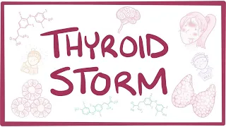 Thyroid storm - causes, symptoms, diagnosis, treatment, pathology