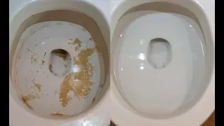 Best Way to Remove Hard Water Stains from your toilet bowl! Clean it NOW!