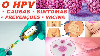 HPV   causas, sintomas e prevenções