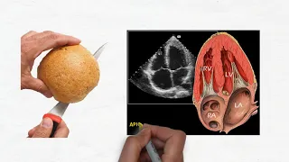 Comparing the basic echo views to slicing a bread roll: POCUS - Dr. Koratala (@NephroP)