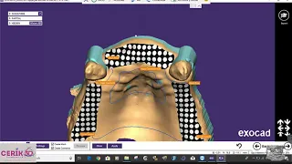 CERIK3D - video 2 - Exocad, Parcial CAD. Diseño digital PPR