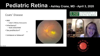 Pediatric Retina Review - April 4, 2020 - Ashley M. Crane, MD