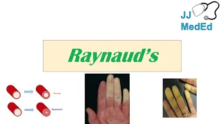 Introduction to Raynaud’s Phenomenon (Syndrome) | Pathophysiology, Triggers, Symptoms, Treatment