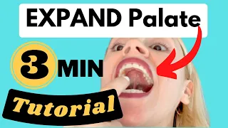 #1 Exercise To Expand Narrow Palate NATURALLY (For Proper Mewing)