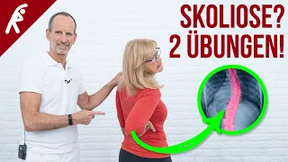 Probiere DIESE 2 Skoliose Übungen gegen deinen krummen Rücken!