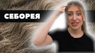 СЕБОРЕЯ кожи головы! Как выглядит? СИМПТОМЫ! Как лечить? Себорейный ДЕРМАТИТ!