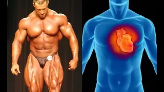 10 Bodybuilders who Died of Heart Attacks before 50