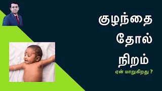 குழந்தை தோல் நிறம் | Baby Skin Colour  | தமிழ்