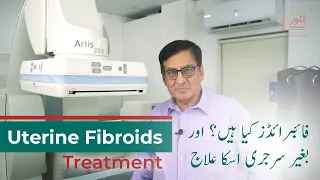 Treatment for Uterine Fibroids