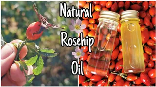 How To Make Rosehip Oil - Easily Step By Step 🌹