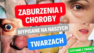 Zaburzenia i choroby wypisane na naszych twarzach. Czytanie z twarzy