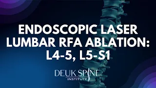 Endoscopic Laser Lumbar RFA Ablation: L4-5, L5-S1