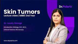 Pathology - Skin Tumors | Introduction, Etiology, SCC, BCC, etc. | MBBS 2nd Year