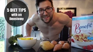 Five Diet Tips for an Ileostomy | Cutting with Crohn's & Colitis | Episode 8