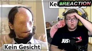 KEIN NASE oder EISERNE LUNGE... 8 einzigartige Menschen mit fehlenden Körperteilen | #iToJuReaction