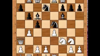 Nakamura vs Carlsen 960 Game1  1/1  27 October 2016