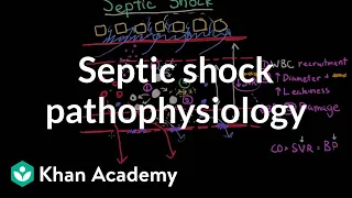 Septic shock - pathophysiology and symptoms | NCLEX-RN | Khan Academy