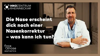 Nasenkorrektur | Frag Prof. Riedel | Die Nase erscheint dick nach einer Nasen-OP – was kann ich tun?